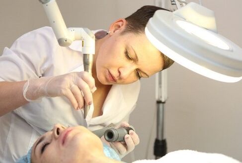 inimese papilloomiviiruse eemaldamine laseriga
